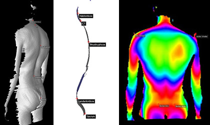 Darstellung einer 3D-Rücken-Analyse