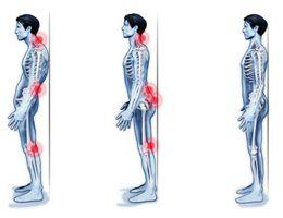 Tag der Rückengesundheit