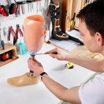 Prothesen Herstellung