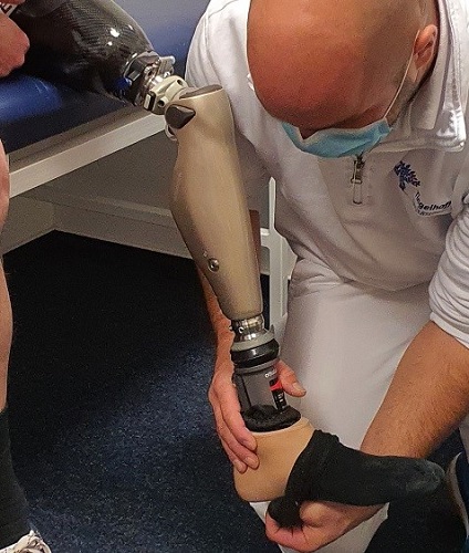 Oberschenkelprothese 3