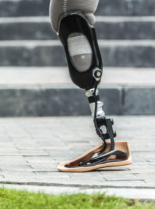 Unterschenkelprothese