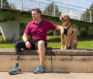 Unterschenkelprothese