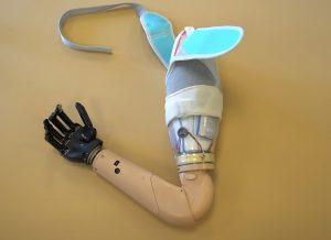 Myoelektrische Armprothese