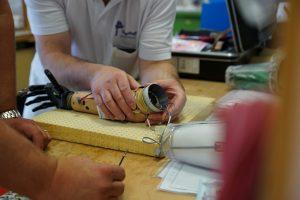 Myoelektrische Armprothesen