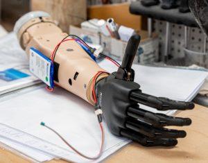 Myoelektrische Armprothesen